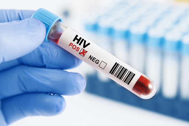 Caring for Patients with HIV/AIDS